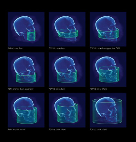 3D-Imaging in calicut