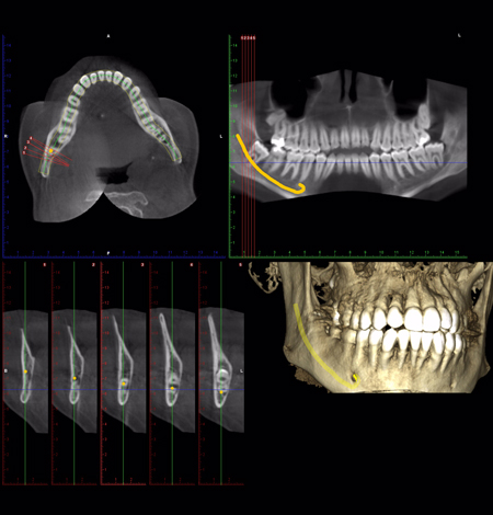 Diagnosis-and-Analysis