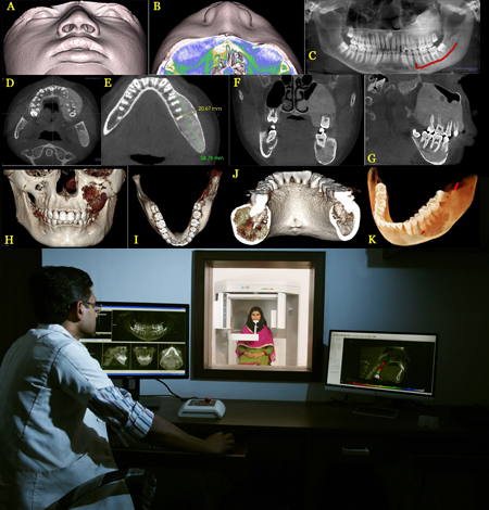 Teleradiology